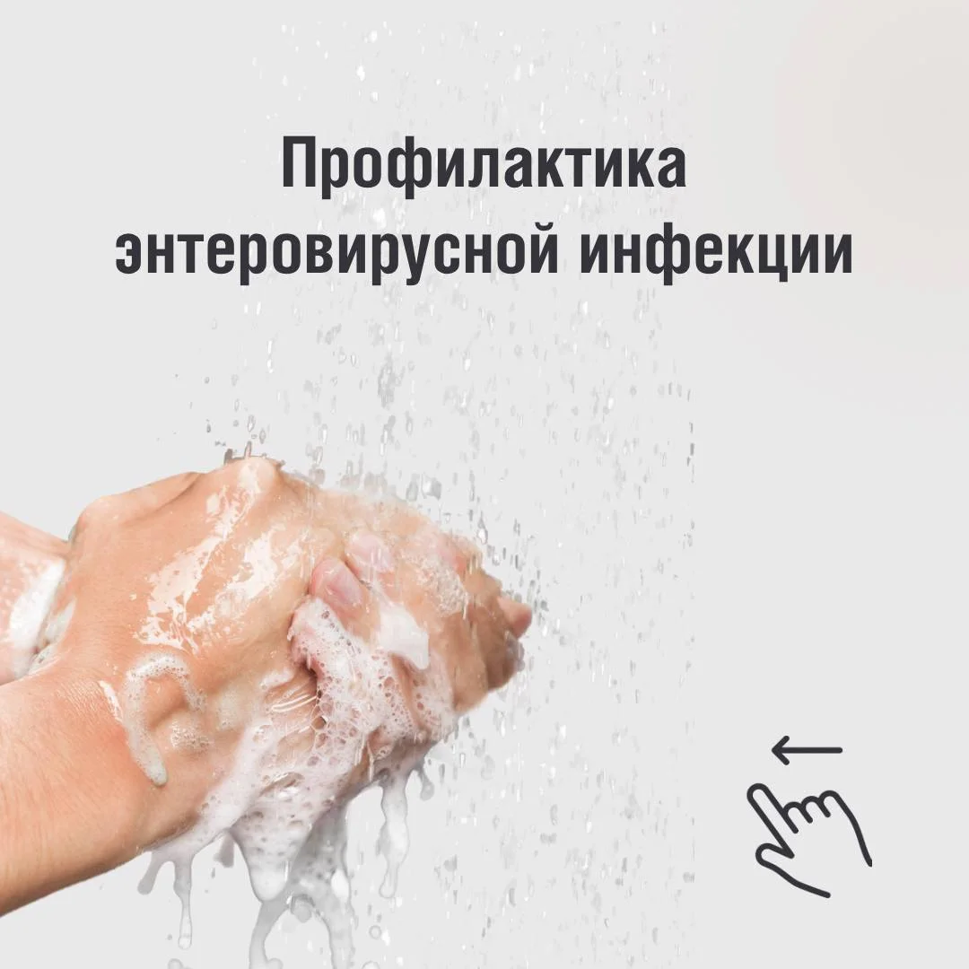 Энтеровирусная инфекция