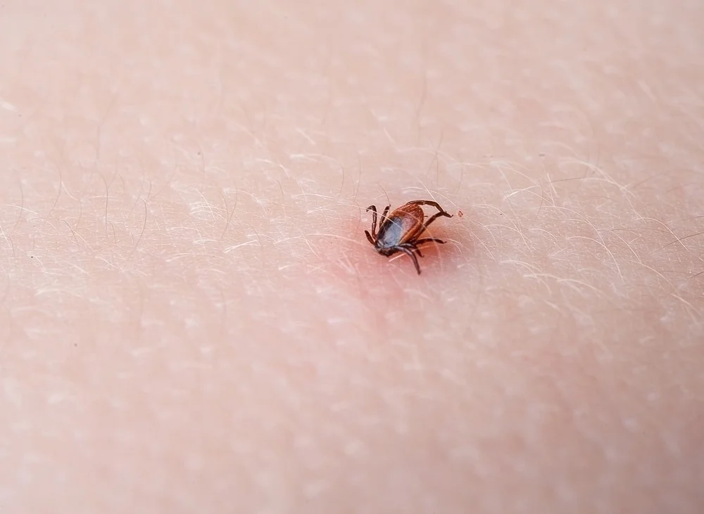 Что делать, если вас укусил клещ?